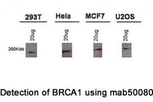 Image no. 2 for anti-Breast Cancer 1 (BRCA1) (AA 1314-1600), (AA 1314-1864) antibody (ABIN363234) (BRCA1 Antikörper  (AA 1314-1600, AA 1314-1864))