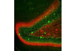 Indirect immunolabeling of the dentate gyrus (PFA fixed) in mouse with anti-calretinin (red, dilution 1 : 500) and anti-parvalbumin (cat.
