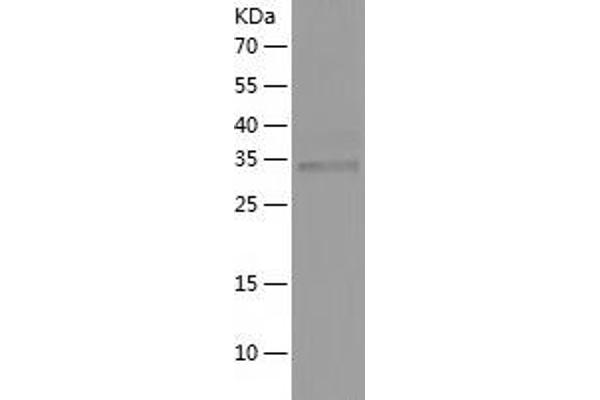 DPPA4 Protein (AA 1-304) (His tag)