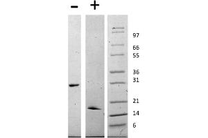 SDS-PAGE of Human Glial Derived Neurotrophic Factor Recombinant Protein SDS-PAGE of Human Human Glial Derived Neurotrophic Factor Recombinant Protein. (GDNF Protein)