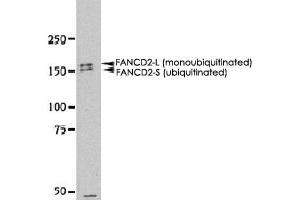 Western blot analysis of FANCD2 in HeLa whole cell extract using FANCD2 polyclonal antibody . (FANCD2 Antikörper  (N-Term))