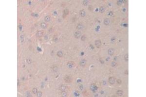 IHC-P analysis of Rat Tissue, with DAB staining. (IL1R1 Antikörper  (AA 226-352))