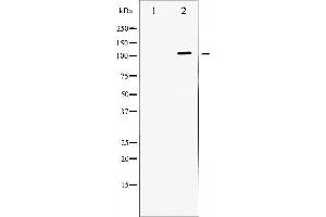 Western Blotting (WB) image for anti-Dynein, Axonemal, Heavy Chain 8 (DNAH8) antibody (ABIN1845418)