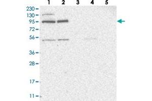 Western blot analysis of Lane 1: RT-4, Lane 2: U-251 MG, Lane 3: Human Plasma, Lane 4: Liver, Lane 5: Tonsil with ZNF341 polyclonal antibody  at 1:250-1:500 dilution. (ZNF341 Antikörper)
