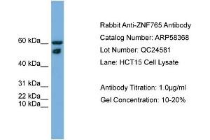 WB Suggested Anti-ZNF765  Antibody Titration: 0. (ZNF765 Antikörper  (N-Term))