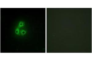 Immunofluorescence analysis of A549 cells, using CSK Antibody. (CSK Antikörper  (AA 31-80))