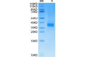 Sclerostin Protein (SOST) (AA 69-258) (His tag)