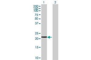 Western Blotting (WB) image for SIRPD 293T Cell Transient Overexpression Lysate(Denatured) (ABIN1338689)