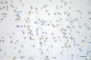 Immunohistochemistry was performed on paraffin-embedded mouse brain using ARID1A antibody (ABIN7797666), 1:200). (Rekombinanter ARID1A Antikörper)