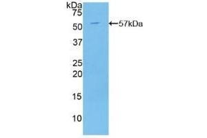 Detection of Recombinant C2CD3, Human using Polyclonal Antibody to C2 Calcium Dependent Domain Containing Protein 3 (C2CD3) (C2CD3 Antikörper  (AA 1432-1647))