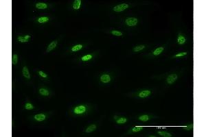 Immunofluorescence of monoclonal antibody to MESP2 on HeLa cell.