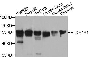 Western blot analysis of extracts of various cell lines, using ALDH1B1 antibody (ABIN5971915) at 1/1000 dilution. (ALDH1B1 Antikörper)