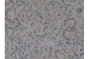 IHC-P analysis of Human Kidney Tissue, with DAB staining. (KRT15 Antikörper  (AA 274-399))