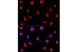 Confocal immunofluorescence analysis of L929 cells using HD Polyclonal Antibody (ABIN3020753, ABIN3020754, ABIN3020755 and ABIN6213707) at dilution of 1:200. (HDAC1 Antikörper  (AA 393-482))