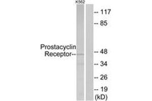 Western blot analysis of extracts from K562 cells, using Prostacyclin Receptor Antibody. (Prostacyclin Receptor Antikörper  (AA 198-247))