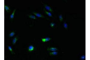 Immunofluorescent analysis of Hela cells using ABIN7144817 at dilution of 1:100 and Alexa Fluor 488-congugated AffiniPure Goat Anti-Rabbit IgG(H+L) (ATL3 Antikörper  (AA 1-187))