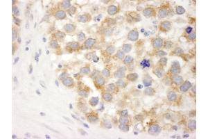 Immunohistochemistry (IHC) image for anti-DEAD (Asp-Glu-Ala-Asp) Box Polypeptide 3, X-Linked (DDX3X) (AA 1-50) antibody (ABIN7448520) (DDX3X Antikörper  (AA 1-50))