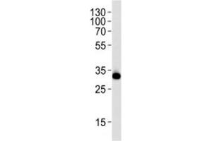Western blot analysis of lysate from HeLa cell line using RPS6 antibody at 1:1000. (RPS6 Antikörper  (AA 220-249))