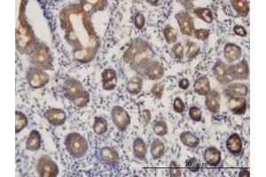 Image no. 1 for anti-Chromosome 21 Open Reading Frame 33 (C21orf33) (AA 188-269) antibody (ABIN599034) (C21orf33 Antikörper  (AA 188-269))