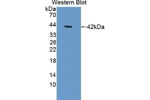 Detection of Recombinant PTMa, Human using Polyclonal Antibody to Prothymosin Alpha (PTMa) (PTMA Antikörper  (AA 2-111))