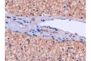 Immunohistochemistry (IHC) image for anti-Thymidylate Synthetase (TYMS) (AA 36-313) antibody (ABIN7436399)