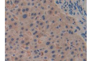 DAB staining on IHC-P; Samples: Human Liver Tissue (RPN1 Antikörper  (AA 180-307))