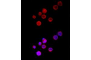 Immunofluorescence analysis of Neuro-2a cells using TRPC5 Rabbit pAb (ABIN6128835, ABIN6149578, ABIN6149579 and ABIN6214219) at dilution of 1:150 (40x lens). (TRPC5 Antikörper  (AA 764-973))