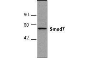 Image no. 1 for anti-SMAD, Mothers Against DPP Homolog 7 (SMAD7) antibody (ABIN127302)