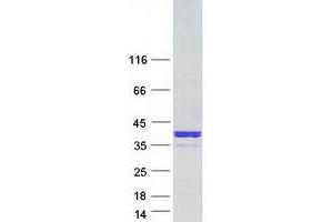 Western Blotting (WB) image for Neugrin, Neurite Outgrowth Associated (NGRN) (Transcript Variant 2) protein (Myc-DYKDDDDK Tag) (ABIN2727112)