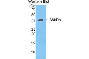 Western blot analysis of the recombinant protein. (FBLN4 Antikörper  (AA 136-225))