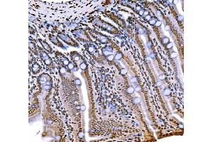 IHC analysis of Histone H1.