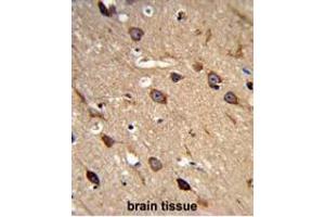 Immunohistochemistry (Paraffin-embedded Sections) (IHC (p)) image for anti-Amiloride-Sensitive Cation Channel 2, Neuronal (ACCN2) (AA 499-528), (C-Term) antibody (ABIN950535)
