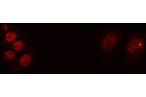 ABIN6276654 staining A549 cells by ICC/IF. (BDNF Antikörper  (Internal Region))