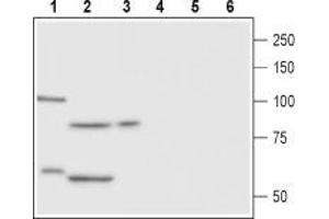 Western blot analysis of rat ovary (lane 1 and 4), rat testis (lane 2 and 5) and human OVCAR3 cell line (lane 3 and 6) lysates:1-3. (Follicle Stimulating Hormone Receptor (FSHR) Peptid)