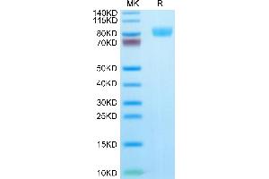 Human IL-17R alpha/CD217 on Tris-Bis PAGE under reduced condition. (IL17RA Protein (AA 33-320) (Fc Tag))