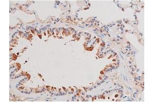 Immunohistochemistry (IHC) image for anti-Adducin 1 (Alpha) (ADD1) (pSer726) antibody (ABIN6255485)