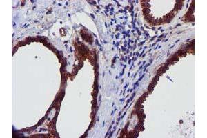 Immunohistochemical staining of paraffin-embedded Human breast tissue using anti-EPN2 mouse monoclonal antibody. (Epsin 2 Antikörper)