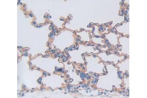 Immunohistochemistry (IHC) image for anti-Tumor Necrosis Factor Receptor Superfamily, Member 10c (TNFRSF10C) (AA 32-244) antibody (ABIN5014477)