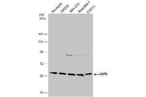 WB Image Various whole cell extracts (30 μg) were separated by 7. (Glucose-6-Phosphate Dehydrogenase Antikörper)