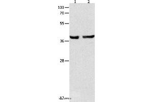 Western blot analysis of Mouse esophagus and human cervical cancer tissue , using SERPINB5 Polyclonal Antibody at dilution of 1:1000 (SERPINB5 Antikörper)