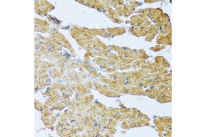 Immunohistochemistry of paraffin-embedded mouse heart using IL20 antibody (ABIN5973987) at dilution of 1/100 (40x lens). (IL-20 Antikörper)