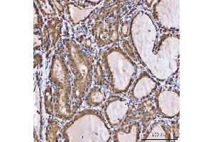IHC analysis of XAF1 using anti-XAF1 antibody (ABIN7600450).