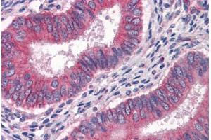Immunohistochemistry (Formalin-fixed Paraffin-embedded Sections) (IHC (fp)) image for anti-Guanylate Binding Protein 1, Interferon-Inducible (GBP1) (AA 1-593) antibody (ABIN574245)