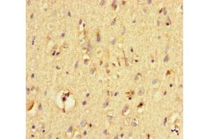 Immunohistochemistry of paraffin-embedded human brain tissue using ABIN7161472 at dilution of 1:100
