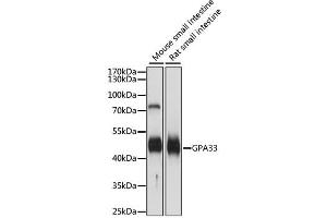 Western blot analysis of extracts of various cell lines, using GPA33 antibody. (GPA33 Antikörper)