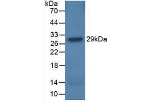 Western blot analysis of recombinant Rat CFH. (Complement Factor H Antikörper  (AA 975-1217))