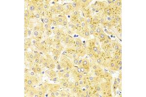 Immunohistochemistry (IHC) image for anti-Wilms Tumor 1 (WT1) (AA 1-302) antibody (ABIN3021698) (WT1 Antikörper  (AA 1-302))