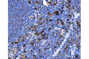 IHC analysis of TXNDC5 using anti-TXNDC5 antibody (ABIN7599699).