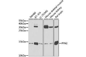 Western blot analysis of extracts of various cell lines, using PFN2 antibody. (PFN2 Antikörper)