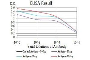 Black line: Control Antigen (100 ng),Purple line: Antigen (10 ng), Blue line: Antigen (50 ng), Red line:Antigen (100 ng) (eIF4EBP1 Antikörper  (pSer65))